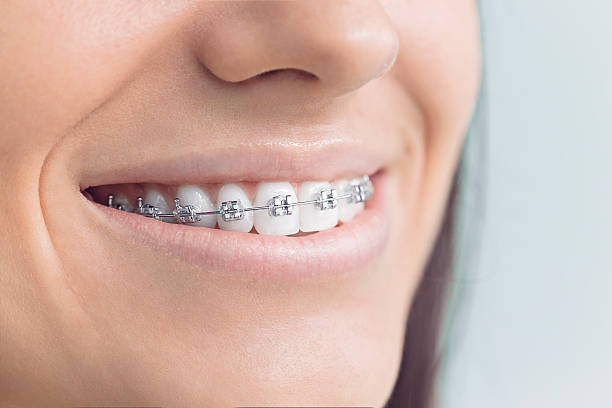 Best Veneers and Lumineers  in Porter, IN